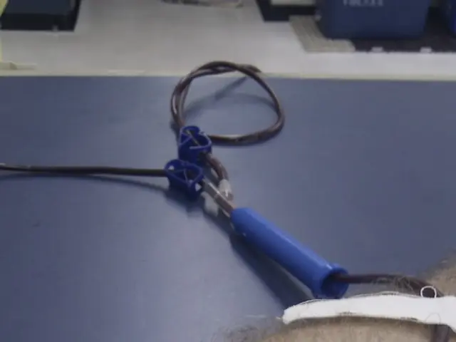 Struggles for Fresenius Medical Care as shares face pressure